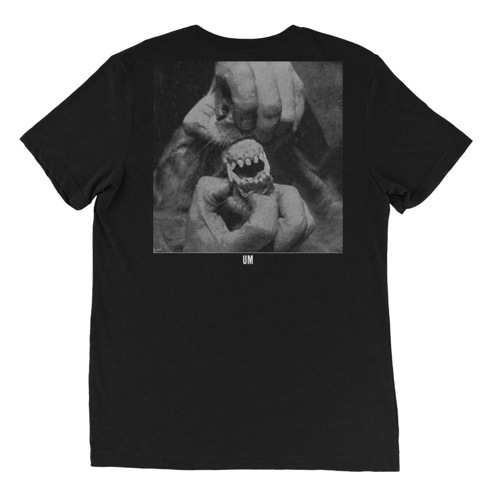 Oral Hygiene T