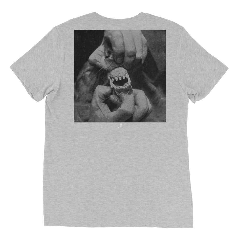 Oral Hygiene T
